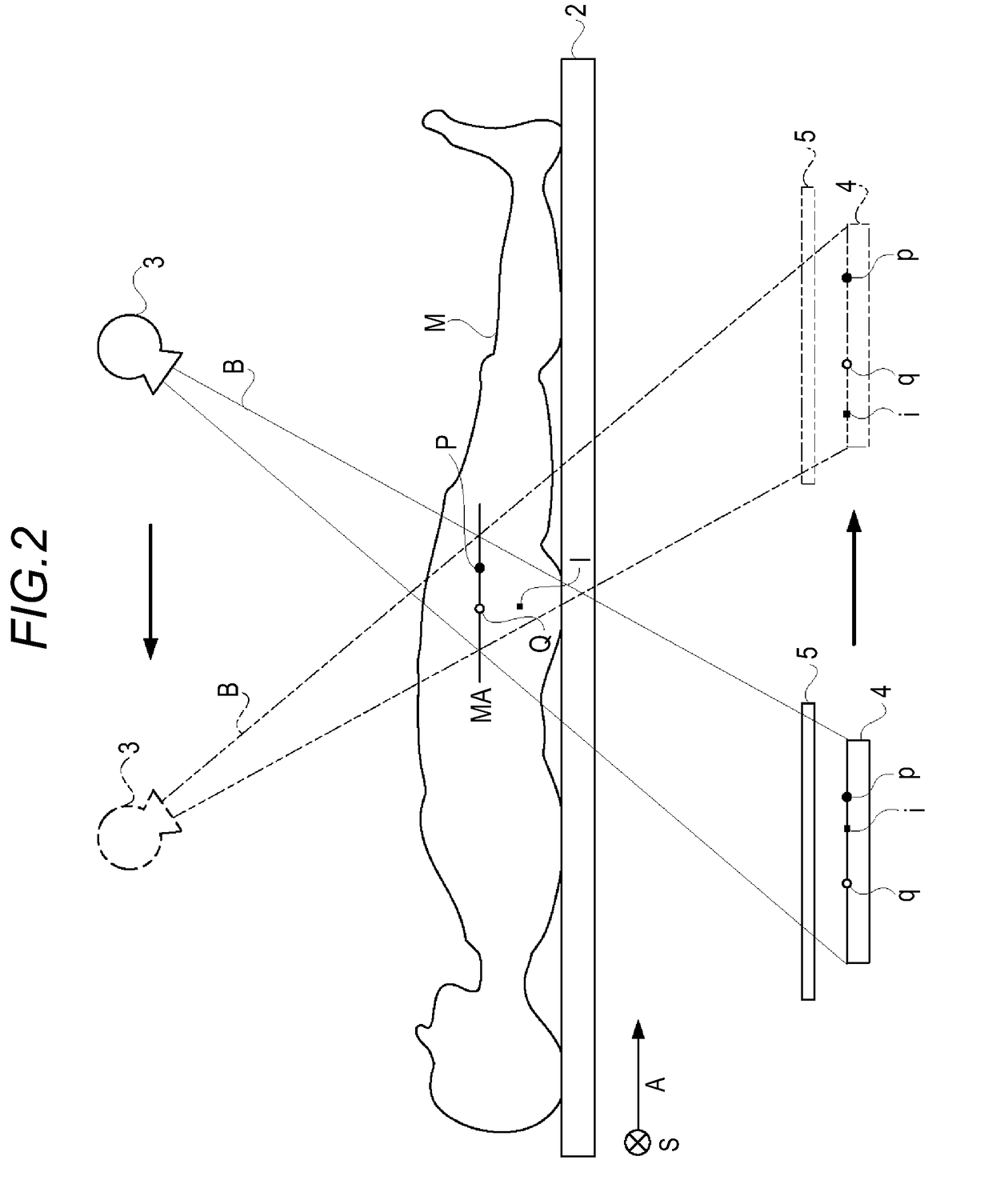 Bone analyzing device