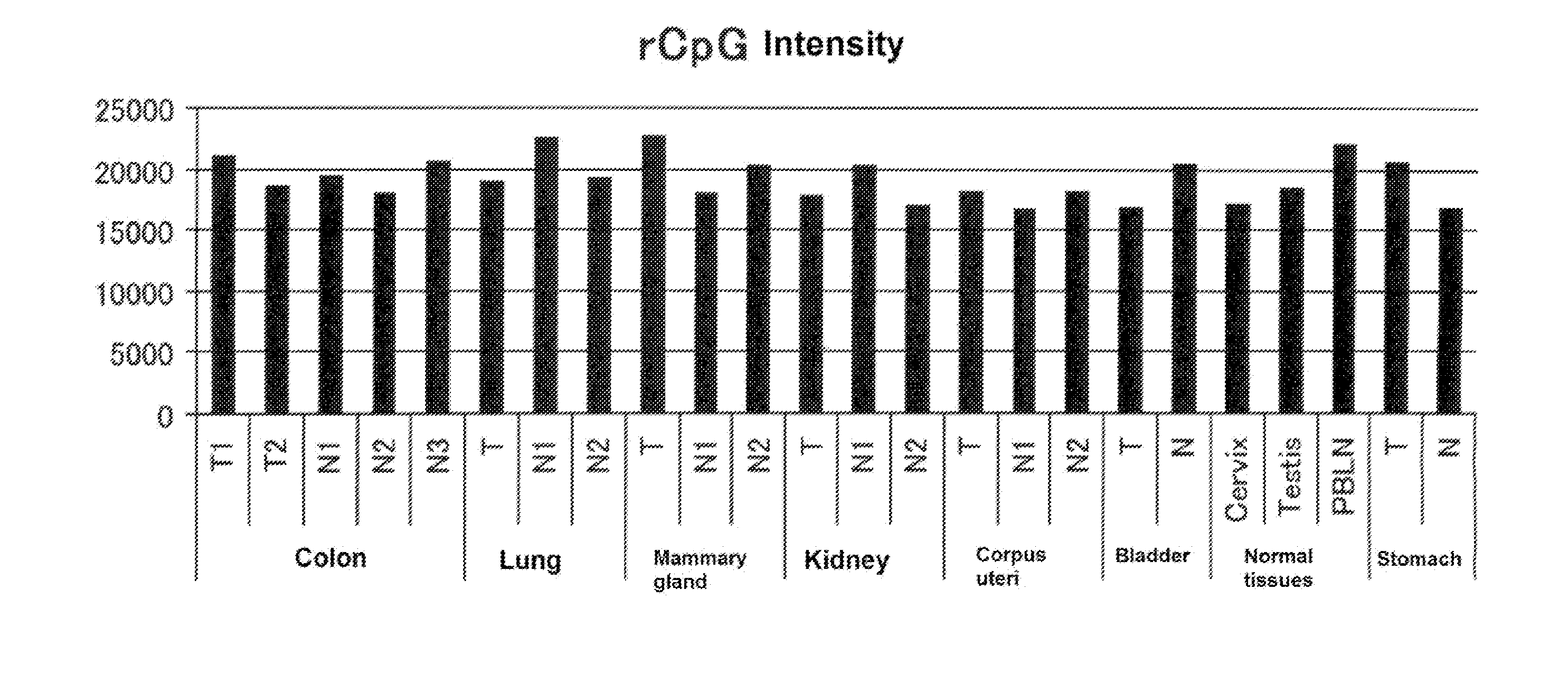 Computer readable medium for enabling a computer to carry out provision of information on hepatocellular carcinoma and marker and kit for obtaining information on hepatocellular carcinoma