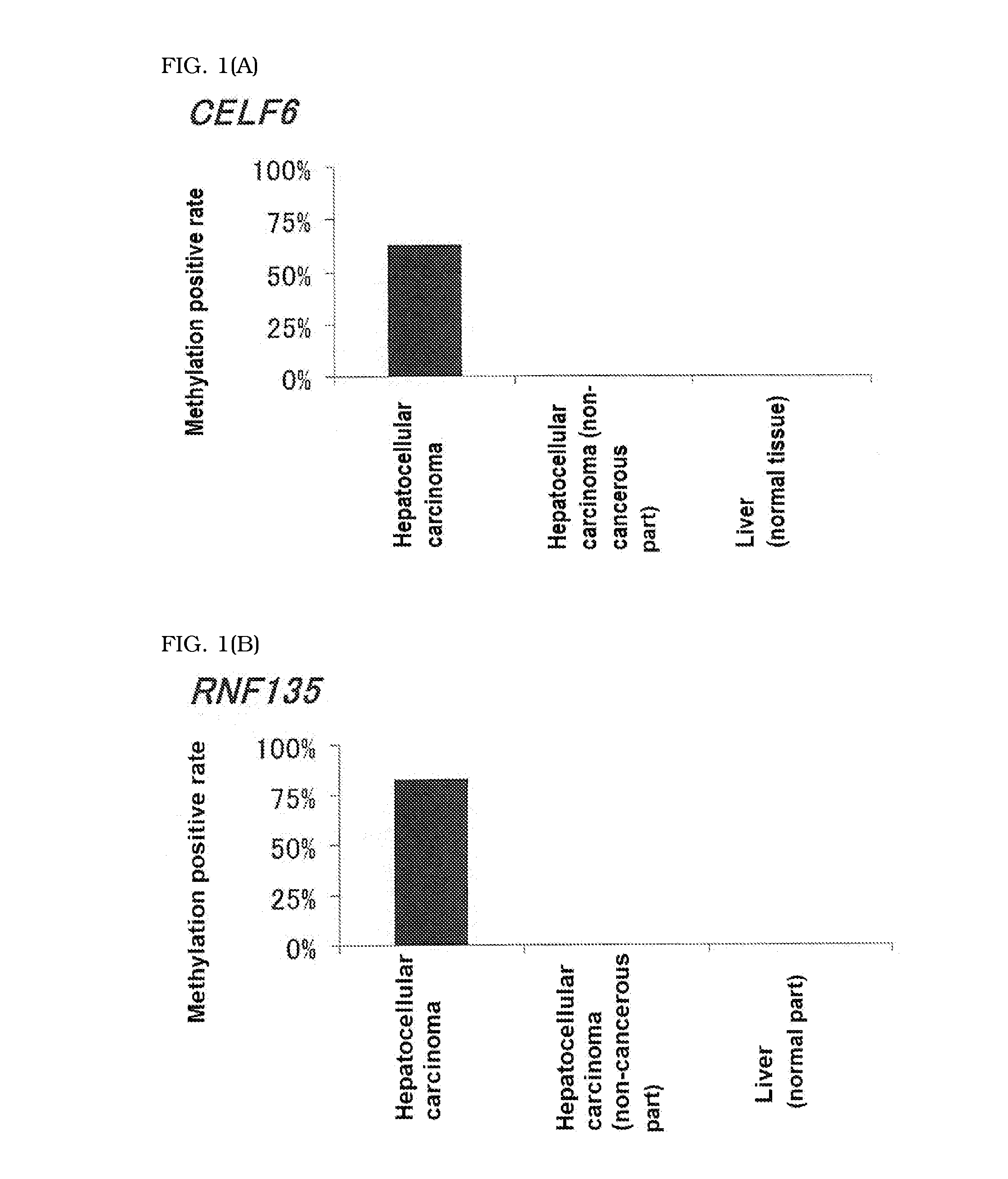 Computer readable medium for enabling a computer to carry out provision of information on hepatocellular carcinoma and marker and kit for obtaining information on hepatocellular carcinoma