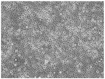 Porcine testicular cell line st-s that can be cultured in suspension and its obtaining method and application