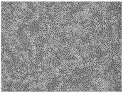 Porcine testicular cell line st-s that can be cultured in suspension and its obtaining method and application