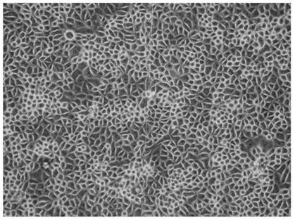 Porcine testicular cell line st-s that can be cultured in suspension and its obtaining method and application