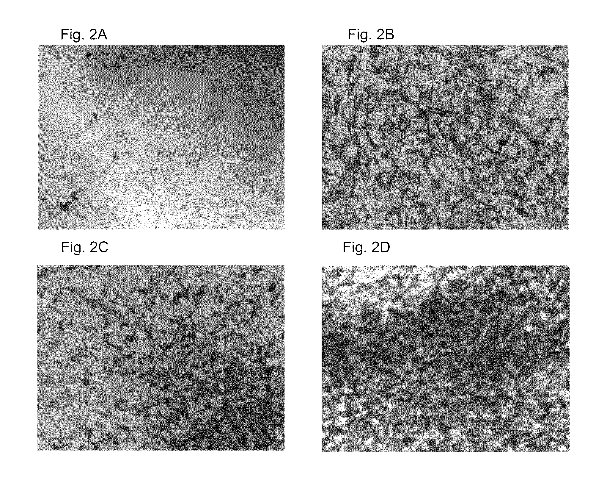 Methods and means for soft tissue engineering