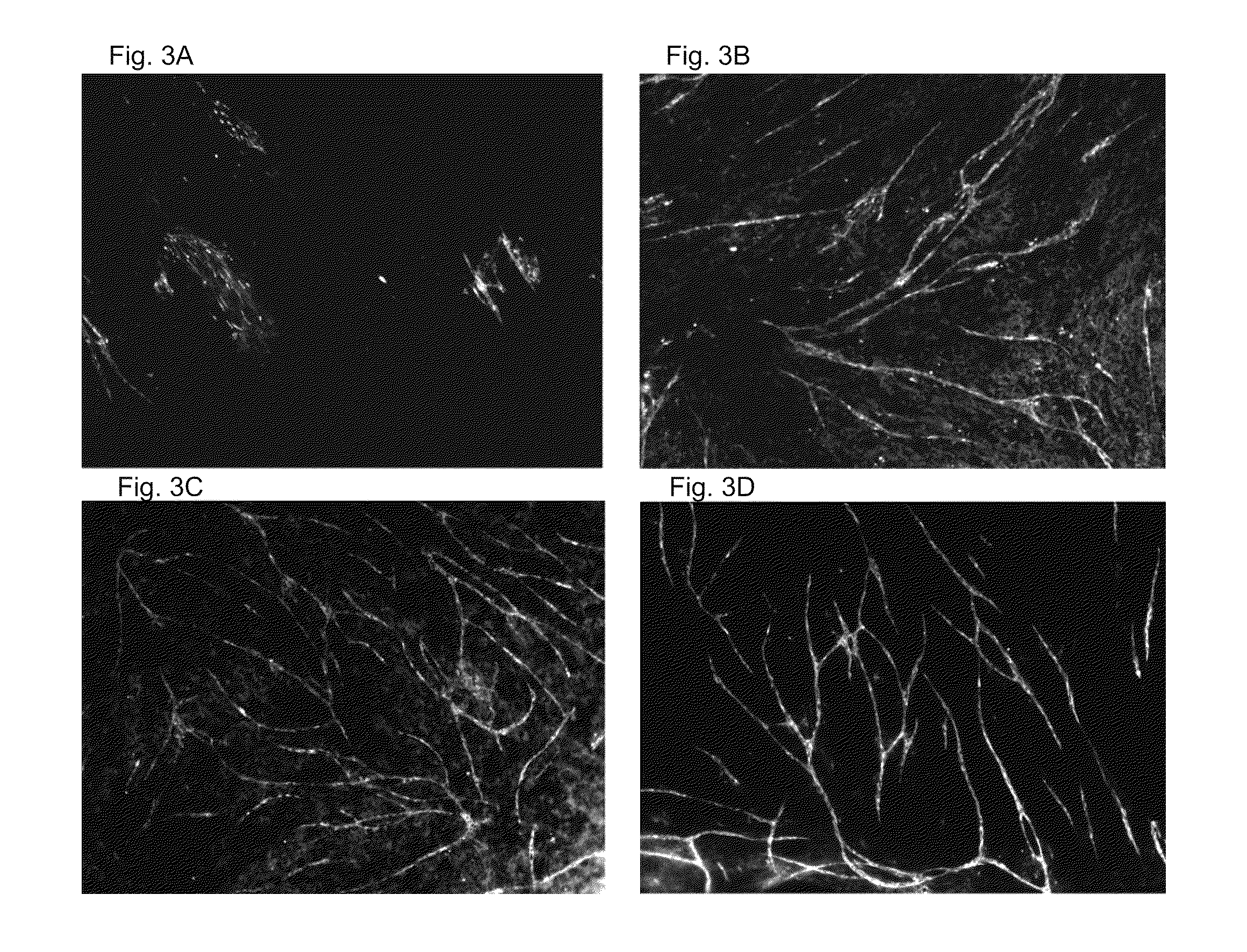 Methods and means for soft tissue engineering