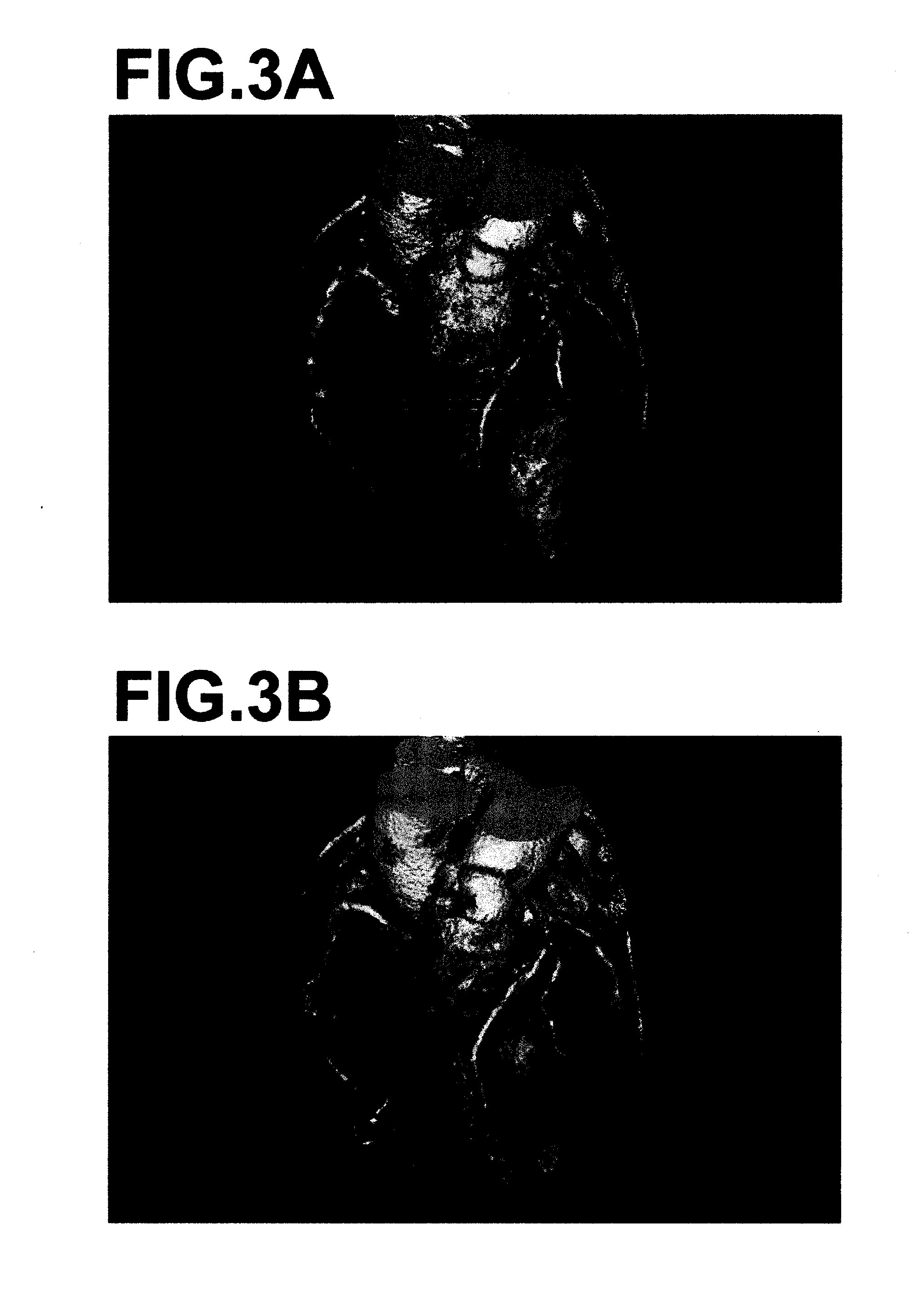 Diagnosis assisting apparatus, coronary artery analyzing method and recording medium having a coronary artery analyzing program stored therein