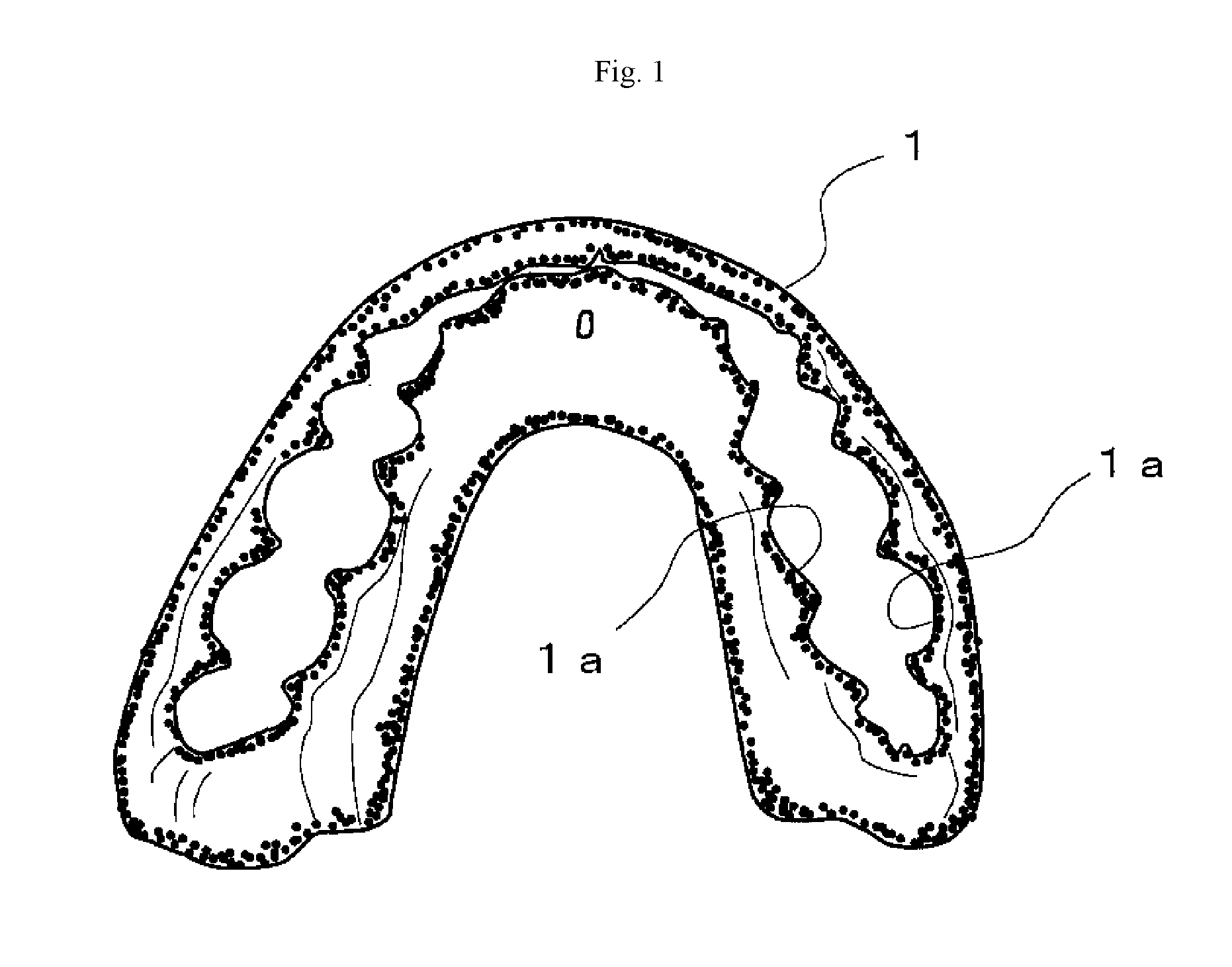 Orthodontic retainer