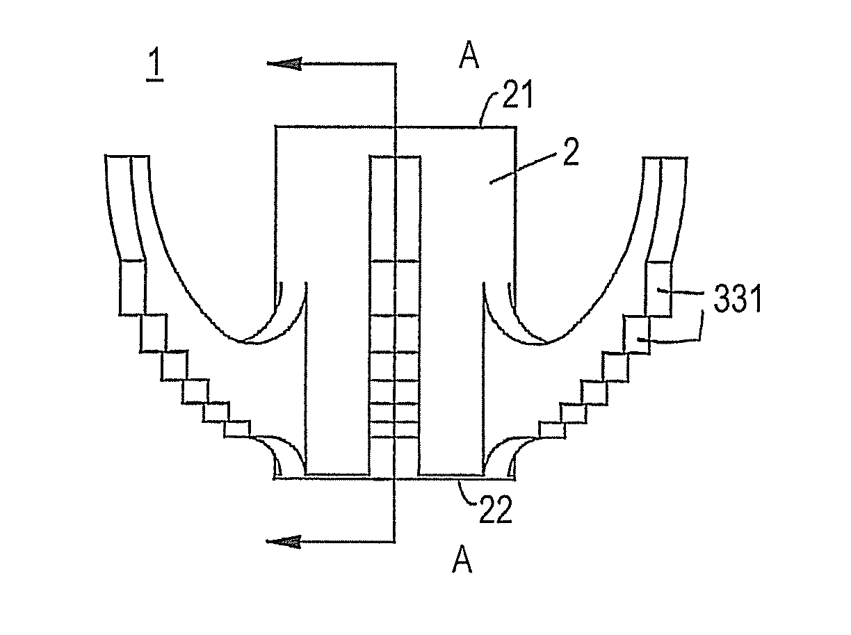 Modular implant for joint prosthesis