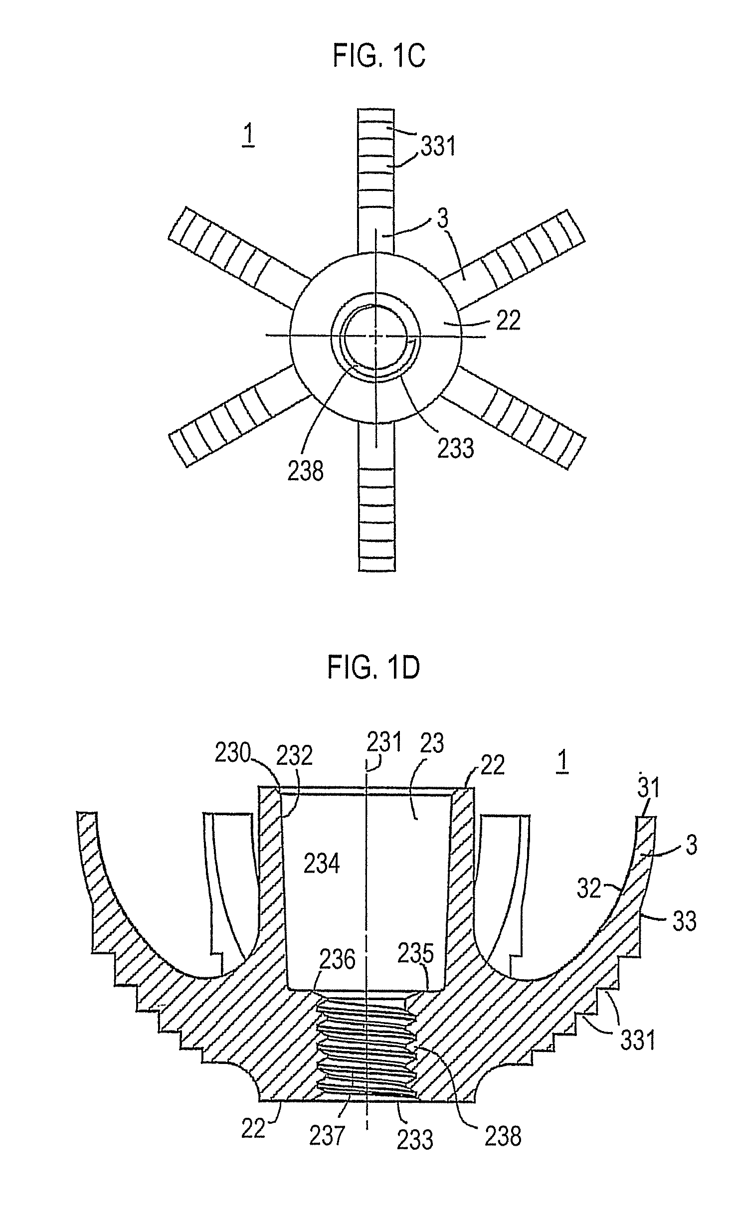 Modular implant for joint prosthesis