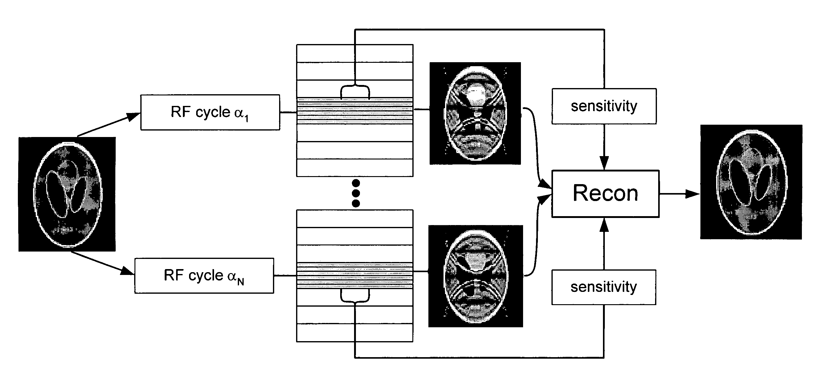 Artifact reduction in SSFP MRI using super field view reconstruction