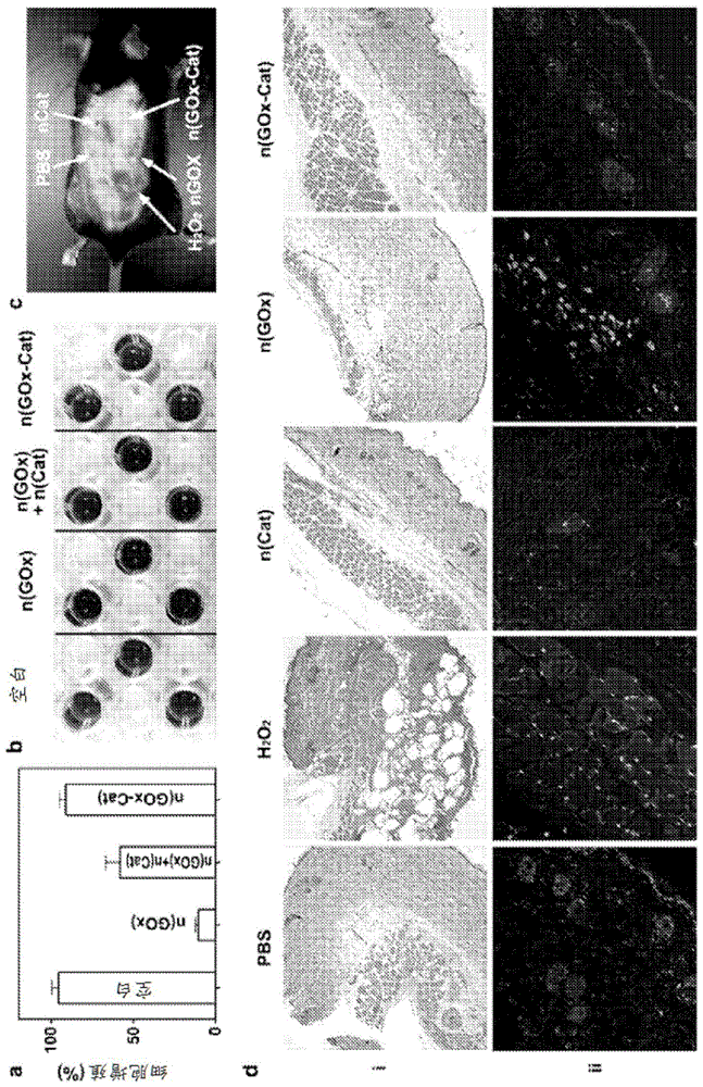 Oral delivery of enzymes using nanocapsules for targeted metabolism of alcohol or toxic metabolites