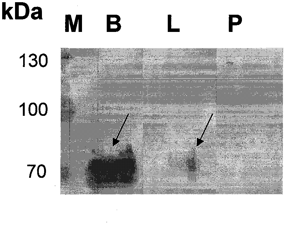 ELISA (Enzyme Linked Immunosorbent Assay) kit for detecting prostate cancer