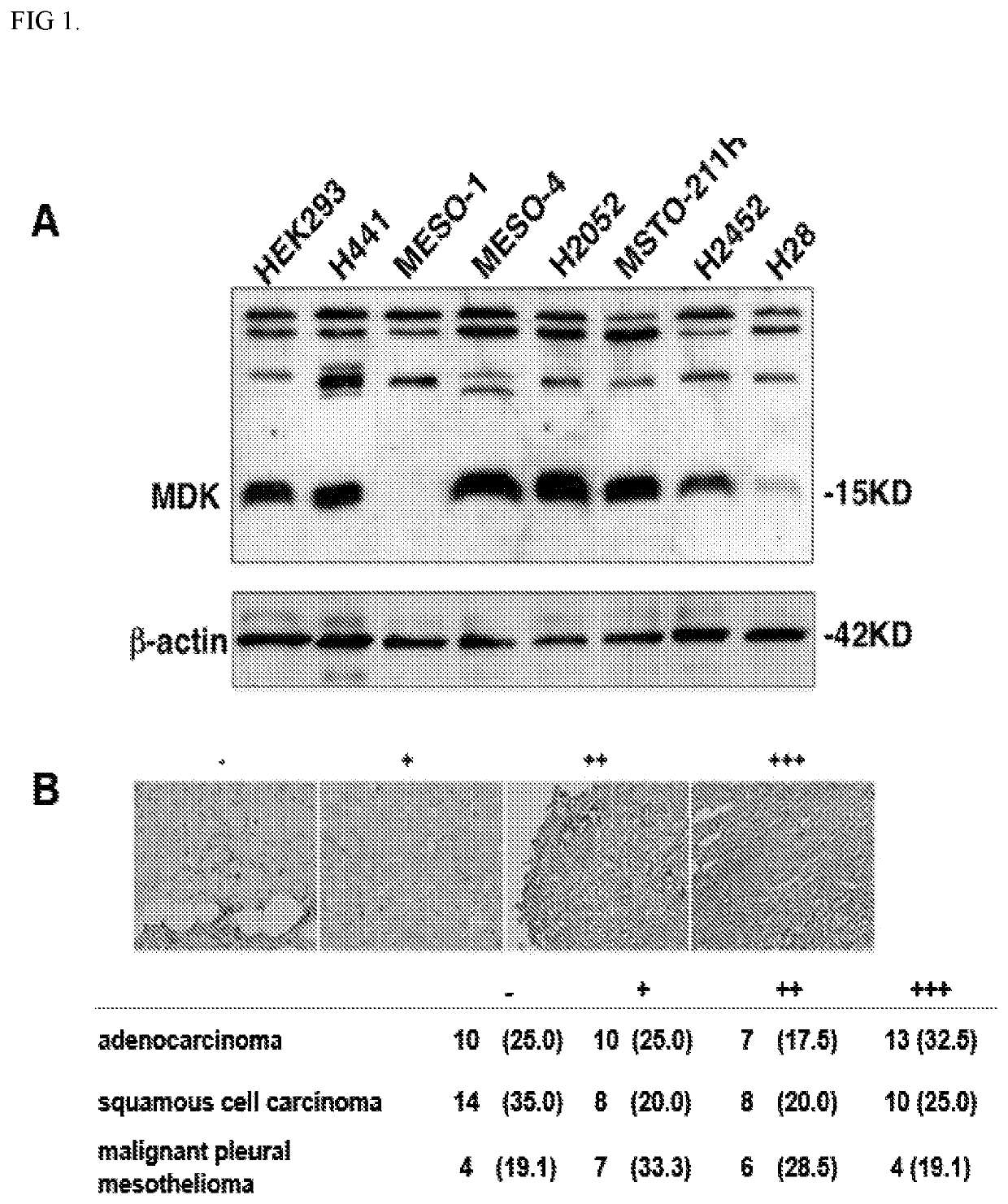 Methods and compositions for treating mesothelioma and small lung cancer that express midkine