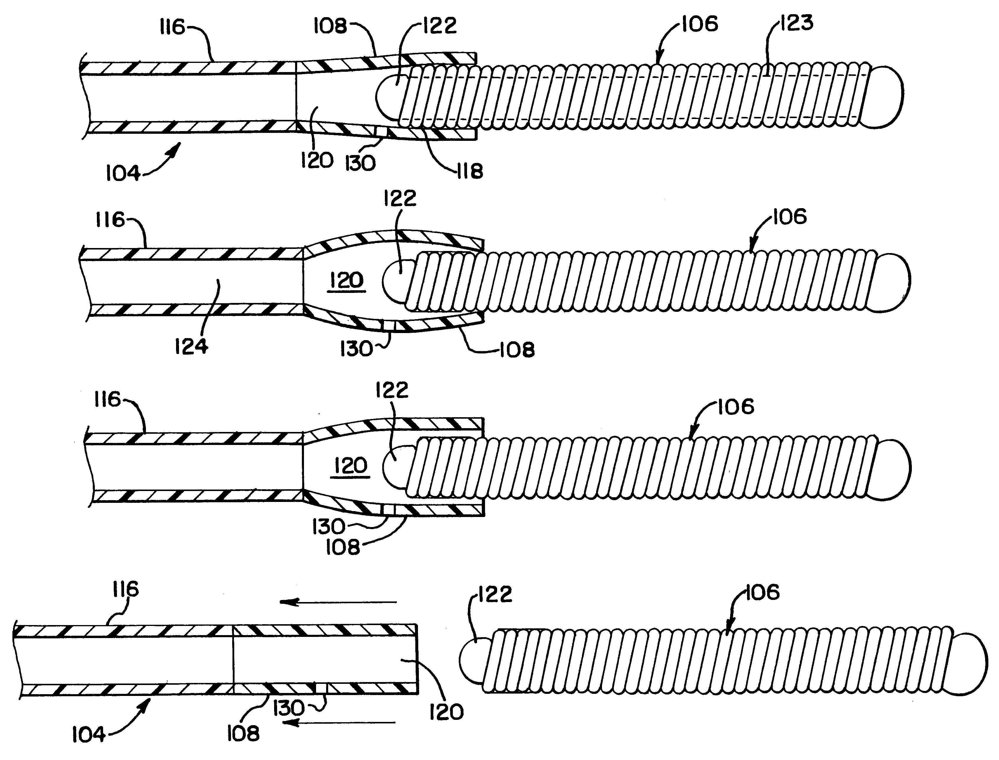 Embolic coil hydraulic deployment system with purge mechanism