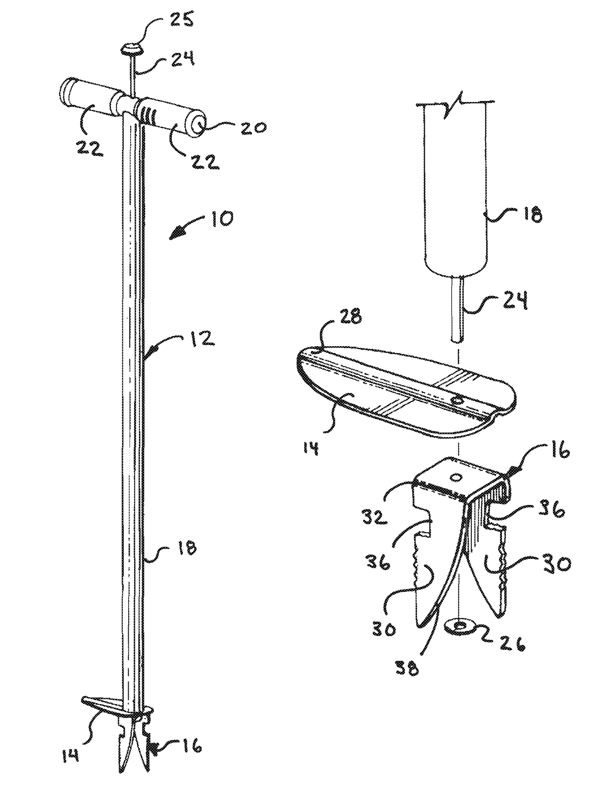 Weed extraction tool