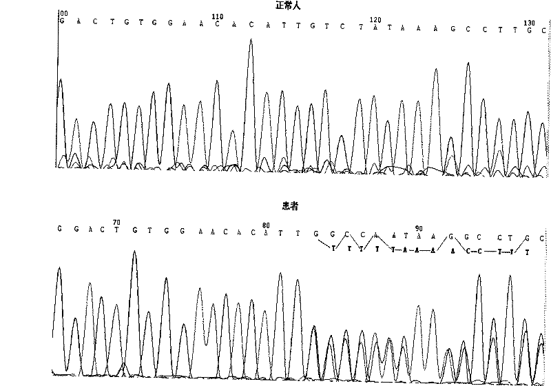 A method and kit for detecting mlh1 gene mutation