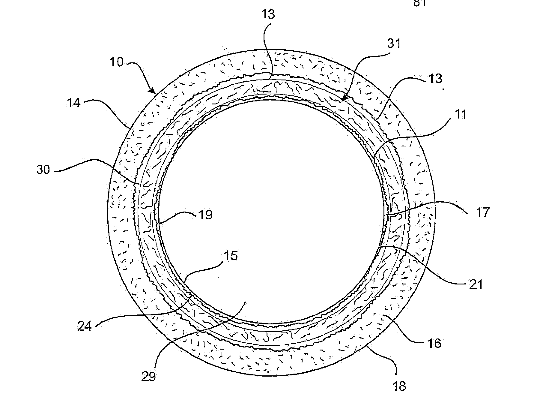 Construction of pipes