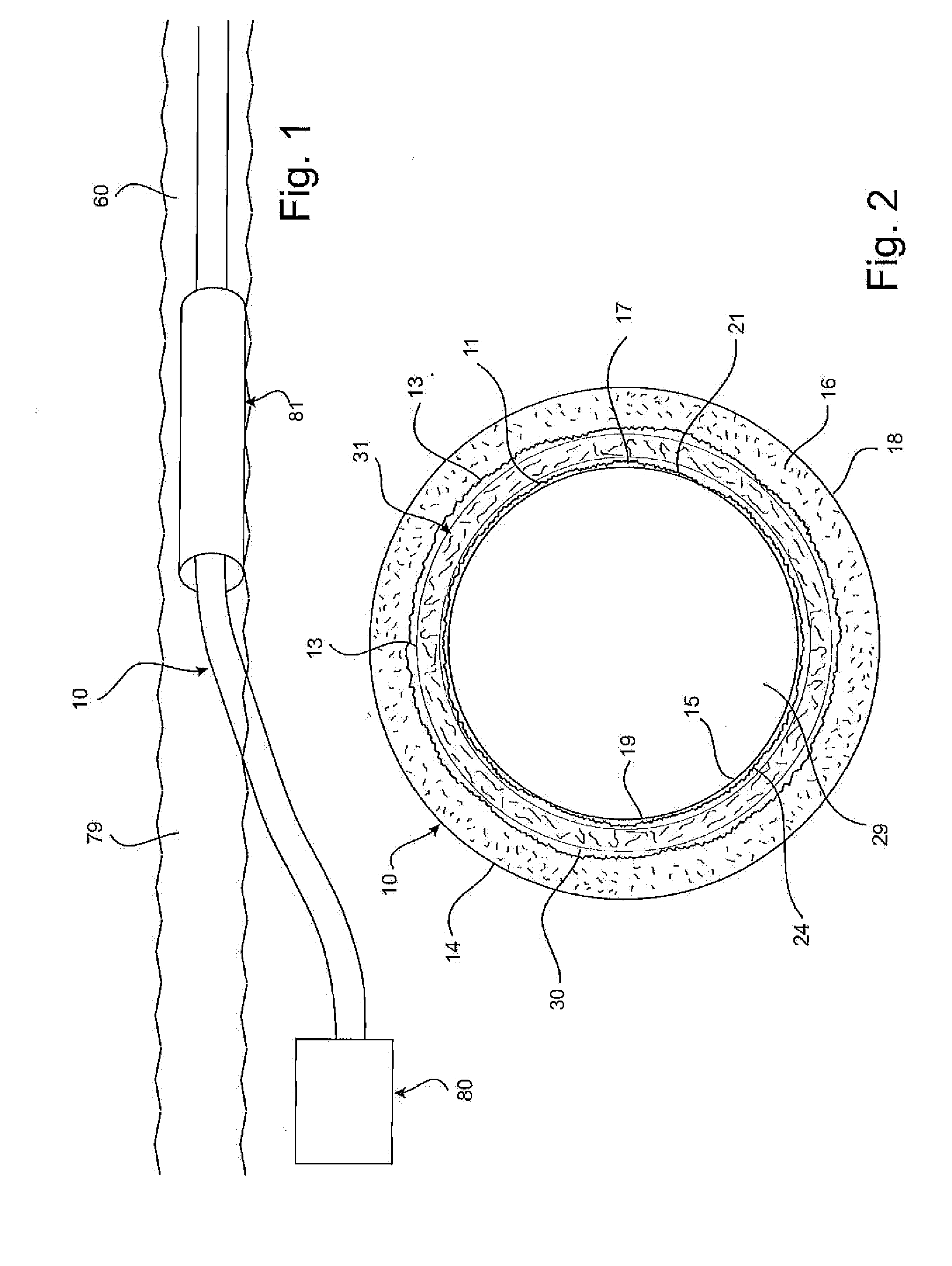 Construction of pipes