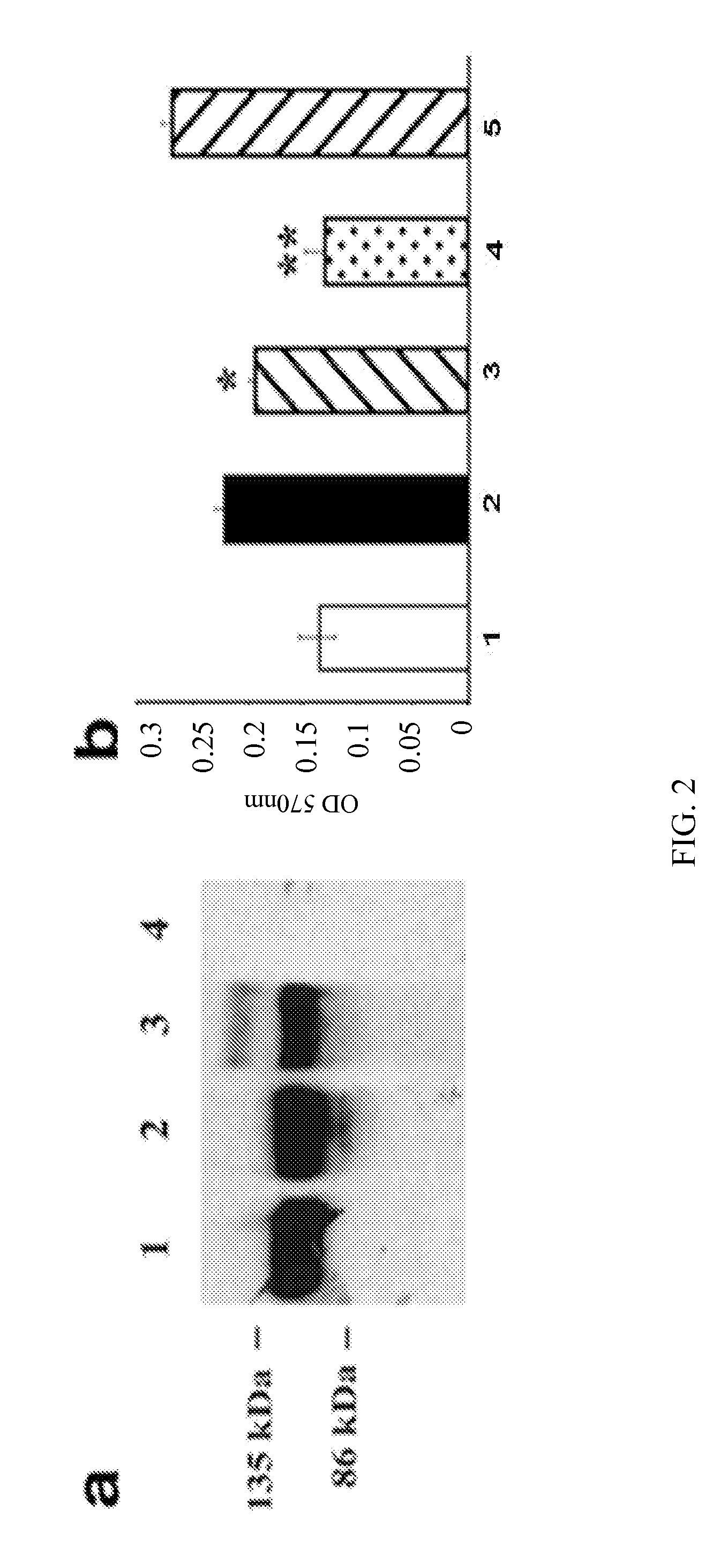 Treatment of AMD using aav sflt-1