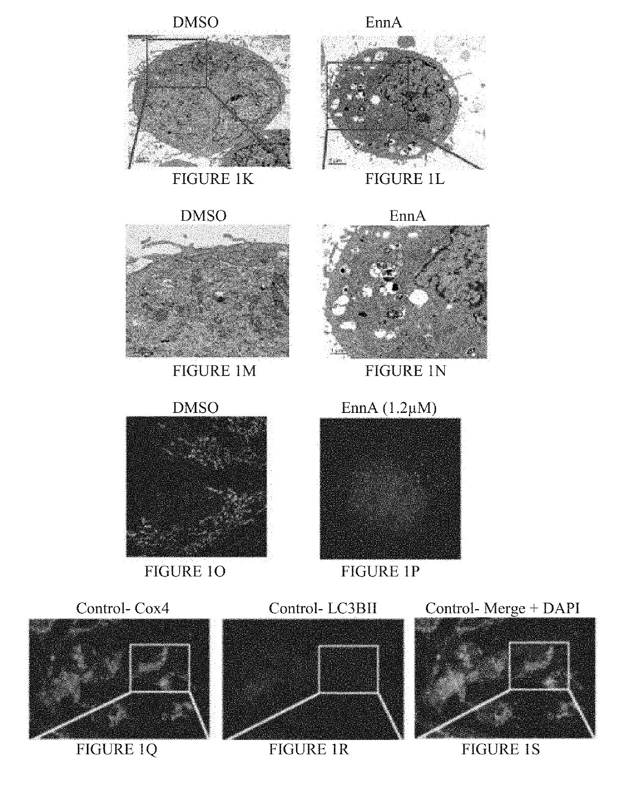 Compositions and Methods for Inhibiting Tumor-Induced Immune Suppression