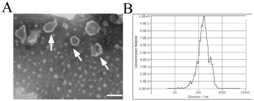 Application of tea exosome in preparation of medicine for protecting intestinal barrier and treating irritable bowel syndrome