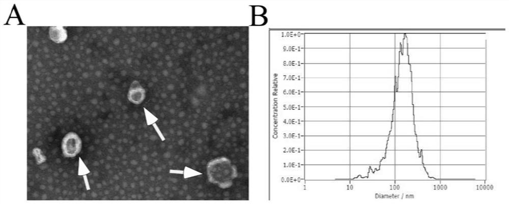 Application of tea exosome in preparation of medicine for protecting intestinal barrier and treating irritable bowel syndrome