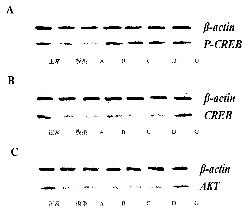 Medicine composition for preventing and treating senile dementia