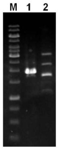 A kind of recombinant bacteria and its application in producing cellulase