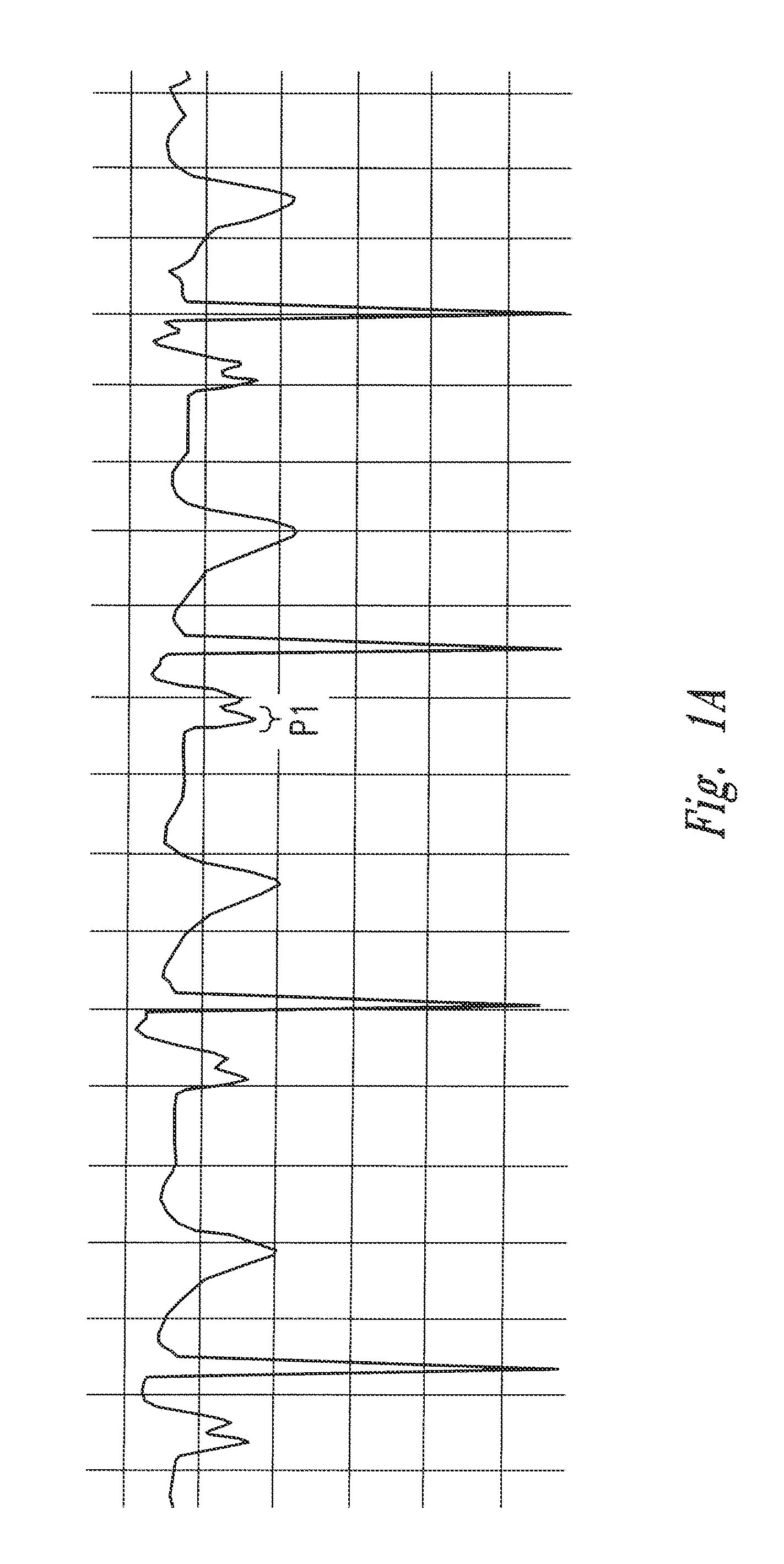 Method of locating the tip of a central venous catheter