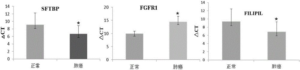 Genetic mark, primer, probe and kit for detecting lung cancer