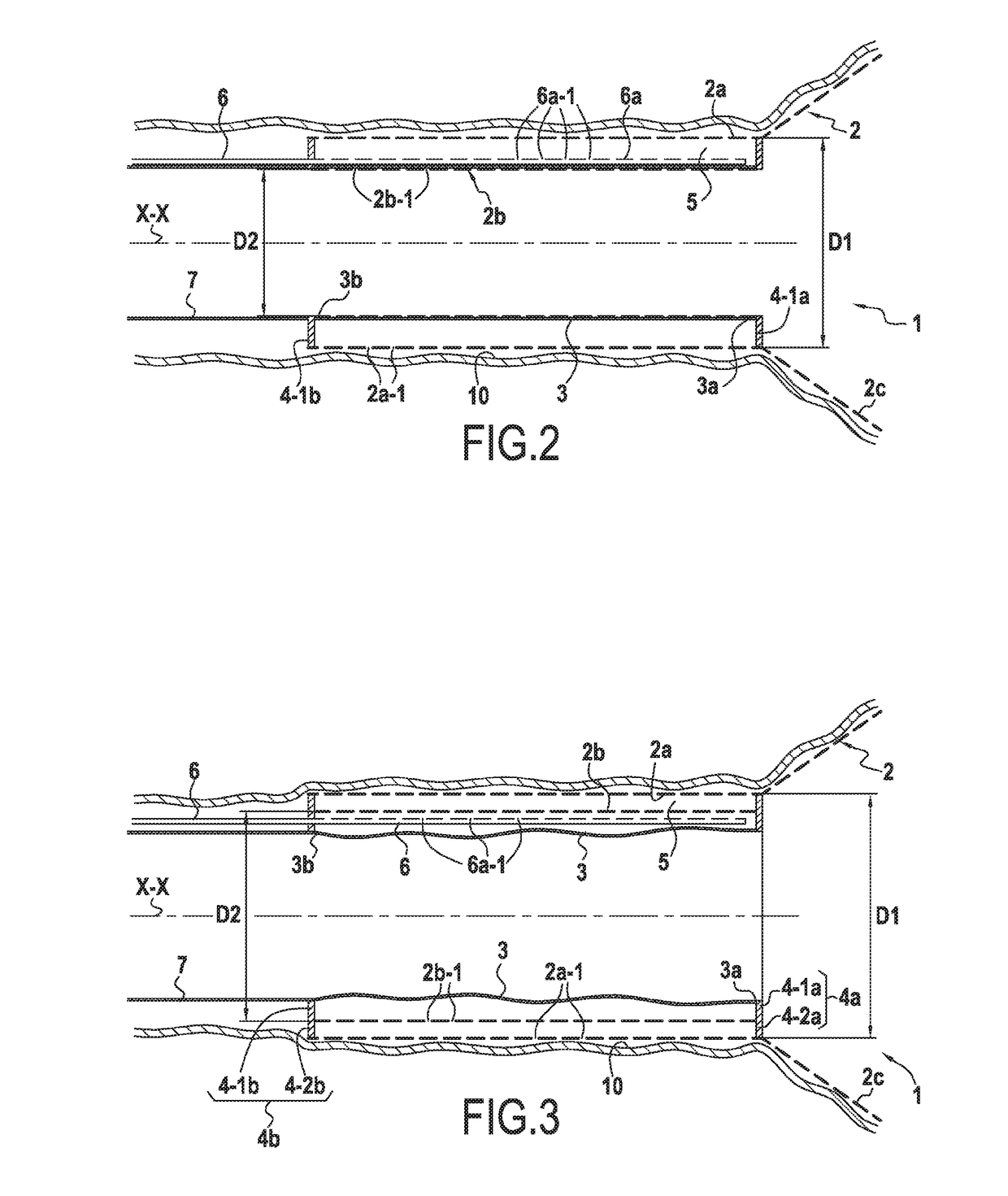 Method of chirurgical treatment using a surgical anchor device