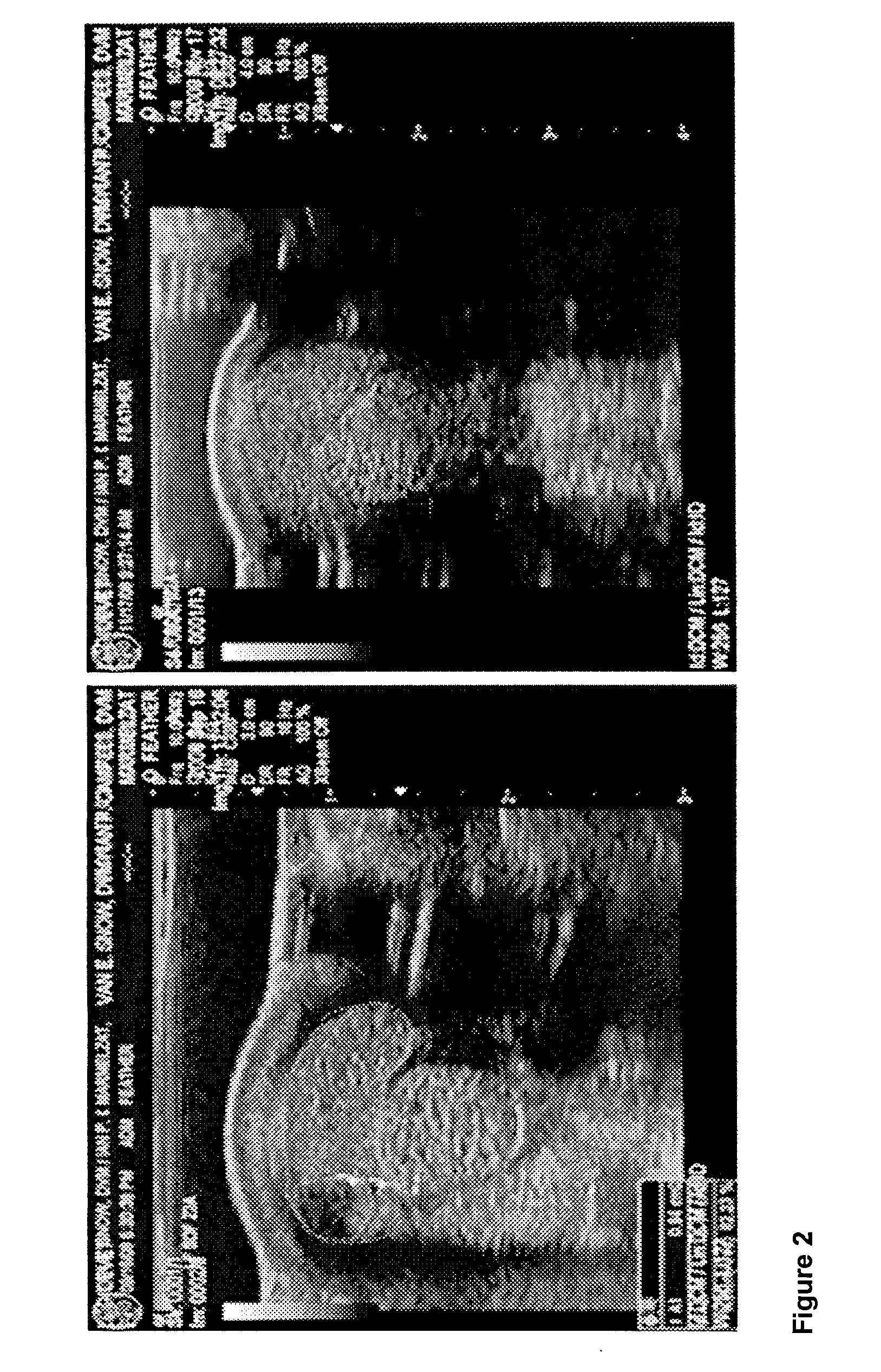 Brain-derived stem cells for repair of musculoskeletal system in vertebrate subjects