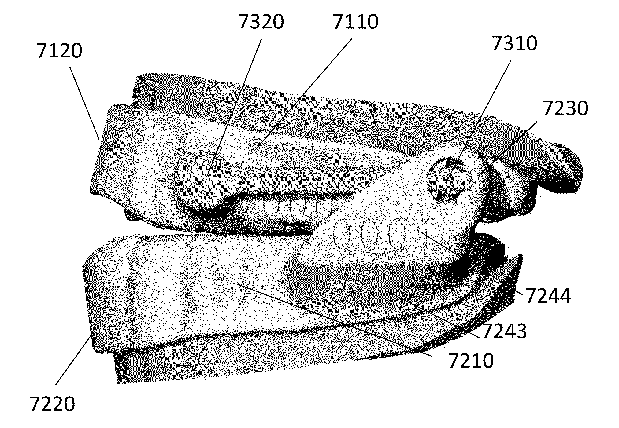 Mandibular repositioning device