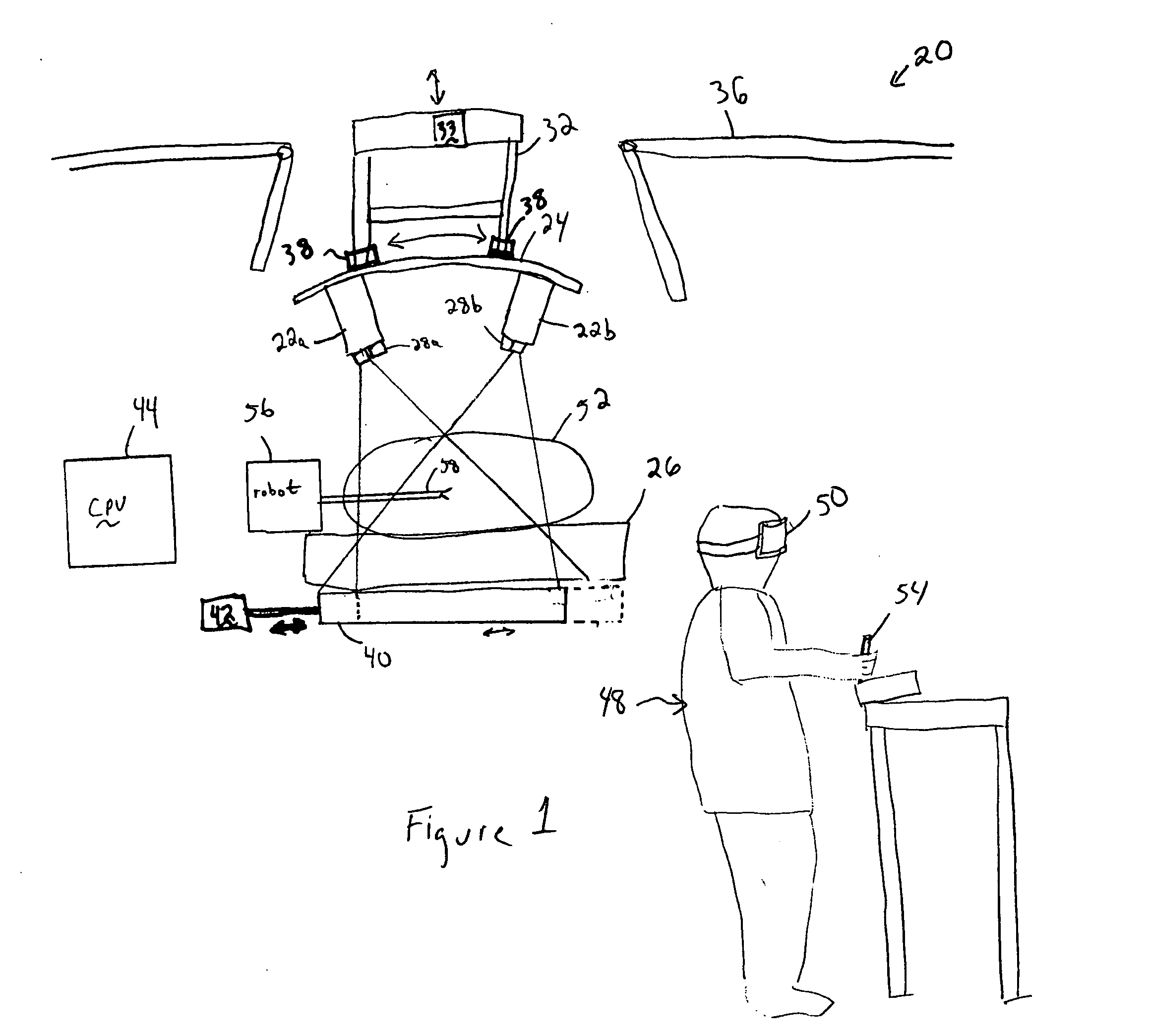 Intraoperative stereo imaging system