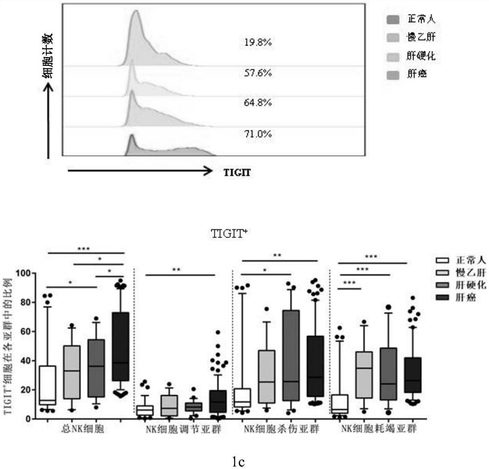 System for determining prognosis of hepatitis B related liver cancer by using TIGIT and TIM-3 on NK cell