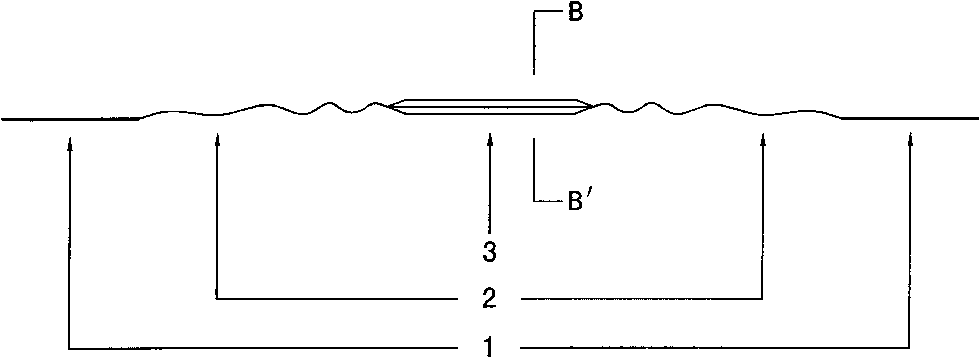 Central type tendon anastomat