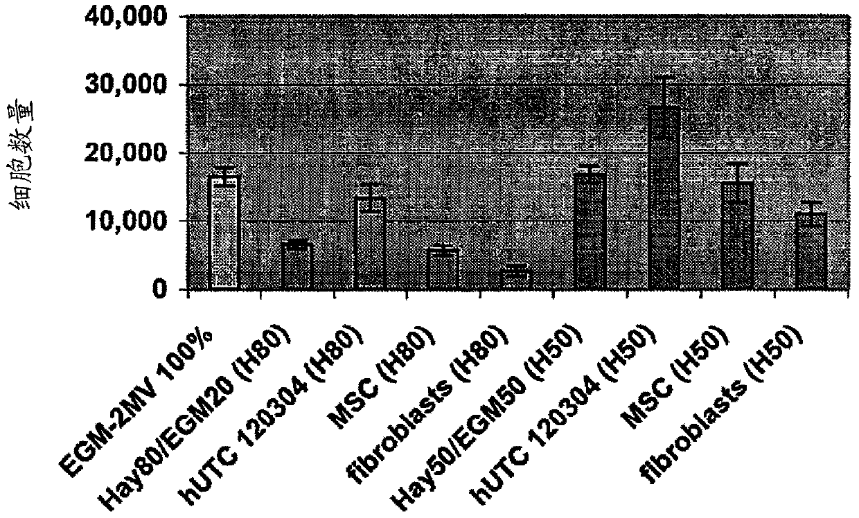 Treatment of peripheral vascular disease using umbilical cord tissue-derived cells