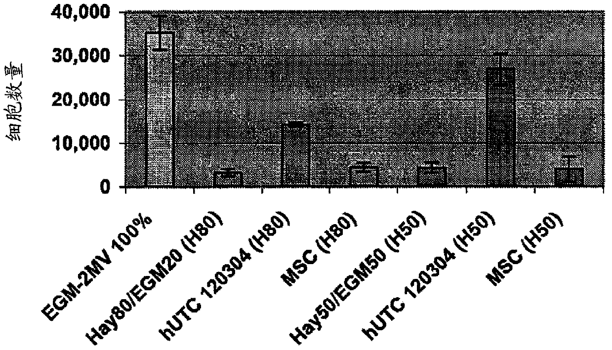 Treatment of peripheral vascular disease using umbilical cord tissue-derived cells