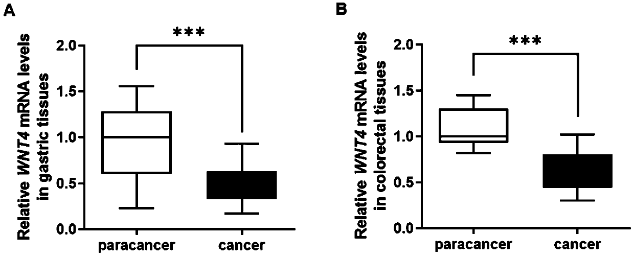 Gastrointestinal malignant tumor marker and application thereof