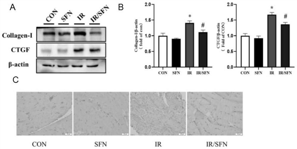 Application of sulforaphane in preparation of drug for inhibiting and/or treating radioactive muscle fibrosis