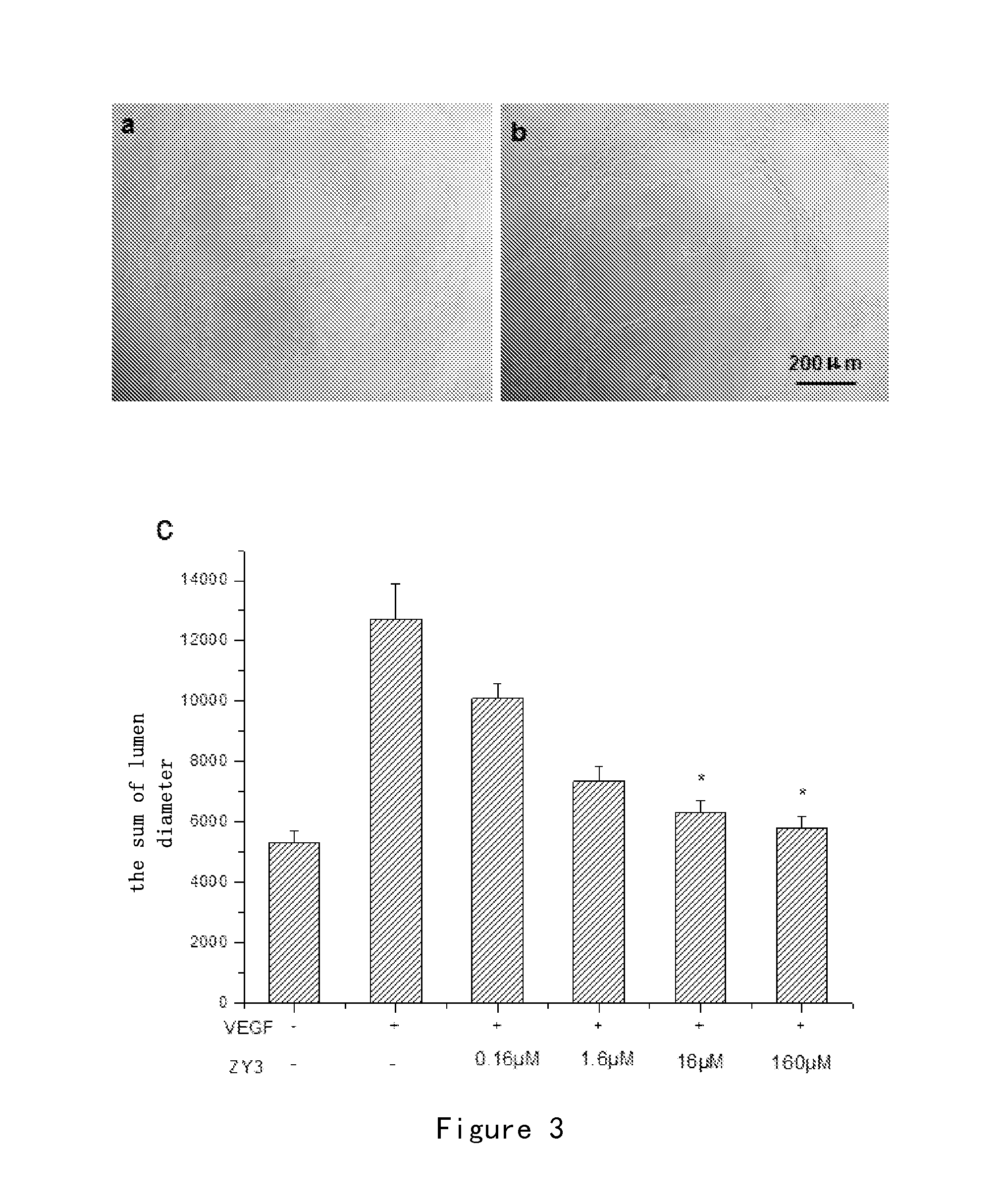 Polypeptides inhibiting neovascularization and uses thereof