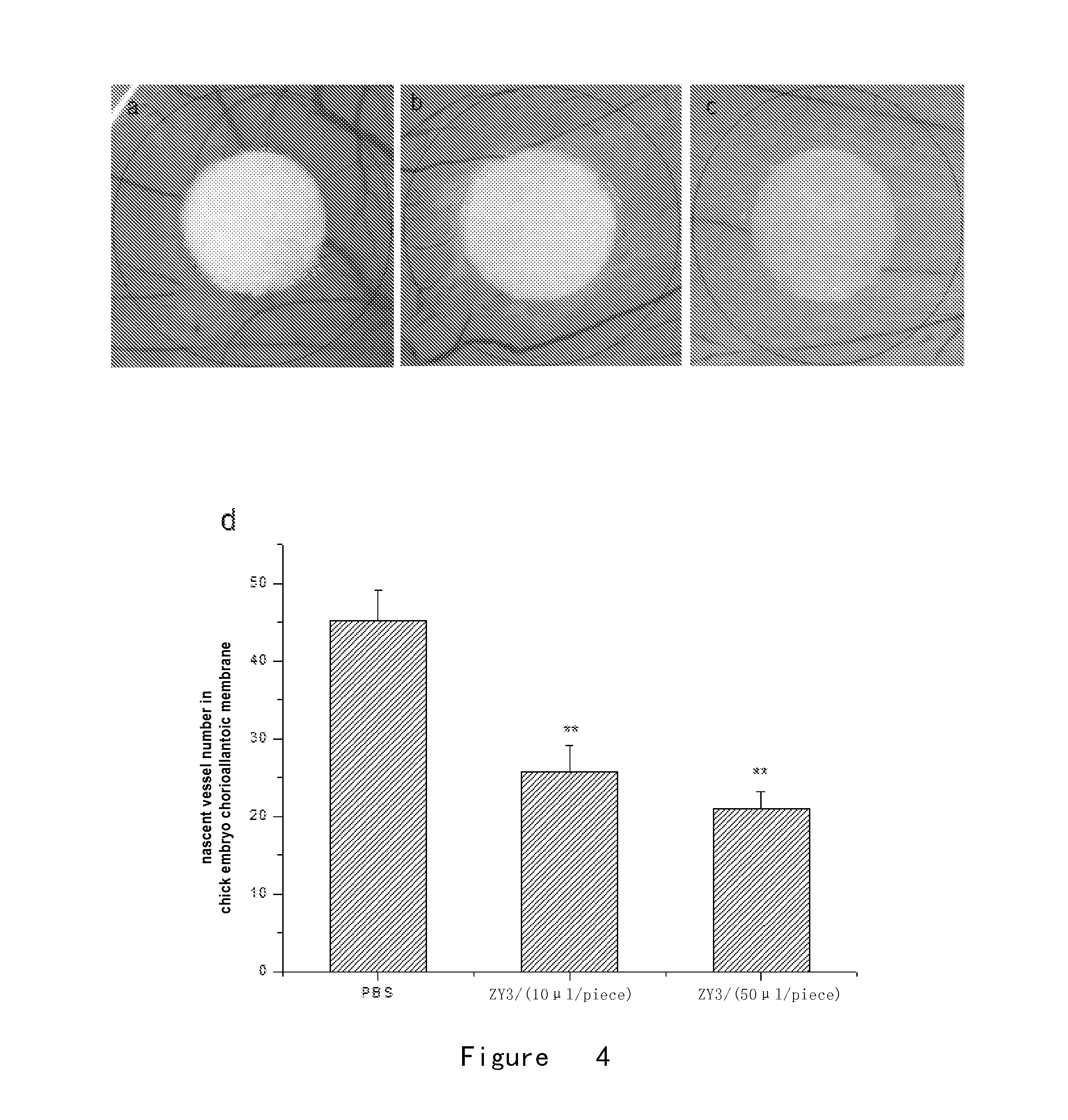 Polypeptides inhibiting neovascularization and uses thereof