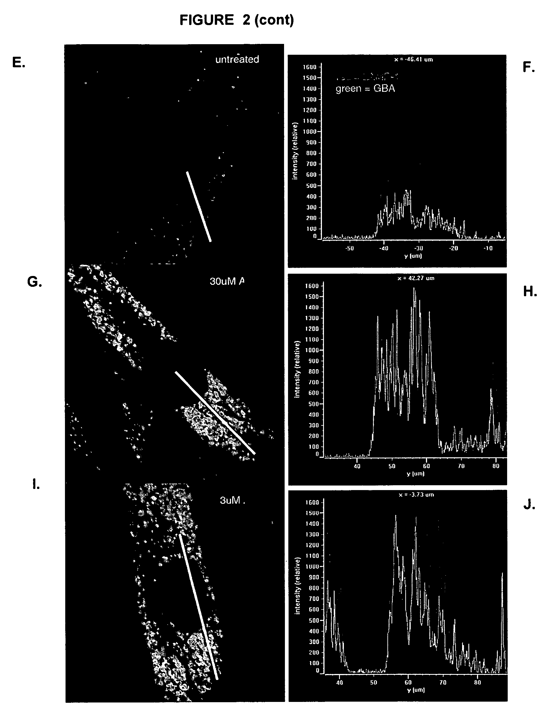 Methods for treating parkinsons disease and parkinsonism