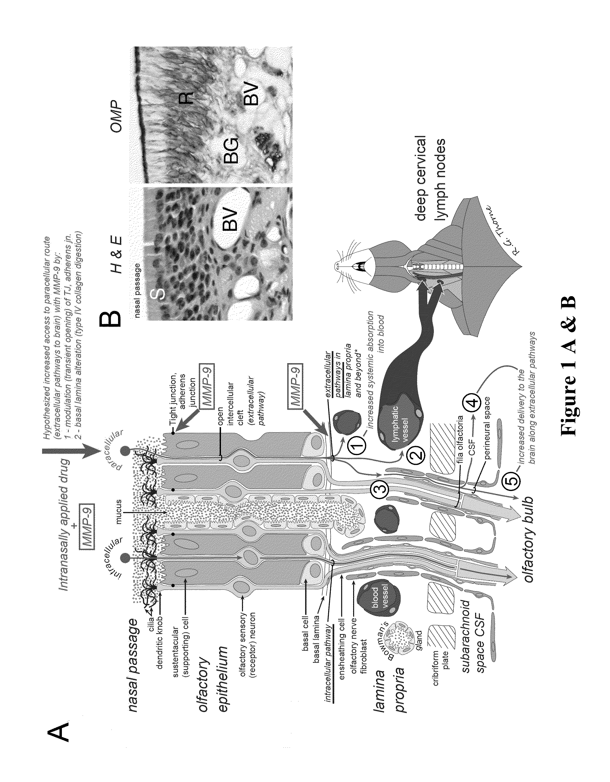 Methods and Compositions for Enhancing Intranasal Delivery of Therapeutic Agents