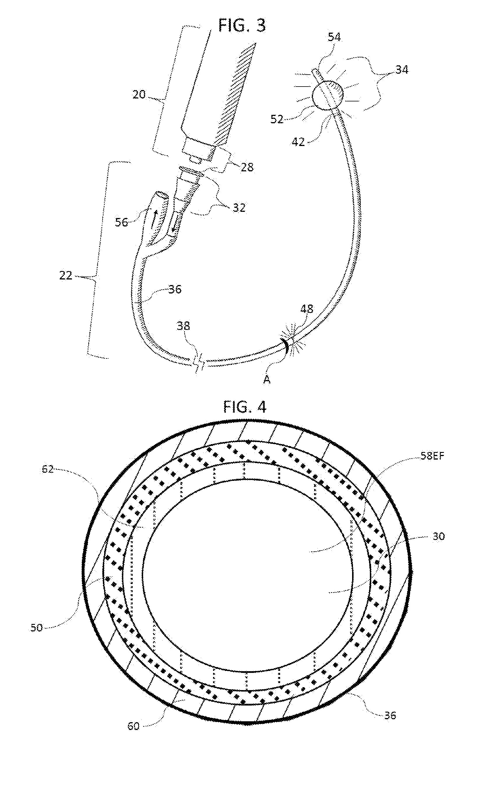 Methods and apparatus to inactivate infectious agents on a catheter residing in a body cavity