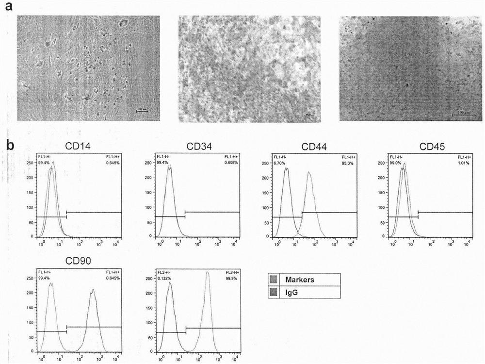 Application of mesenchymal stem cells combined with TPO and analogues thereof in treatment of chronic myeloid leukemia