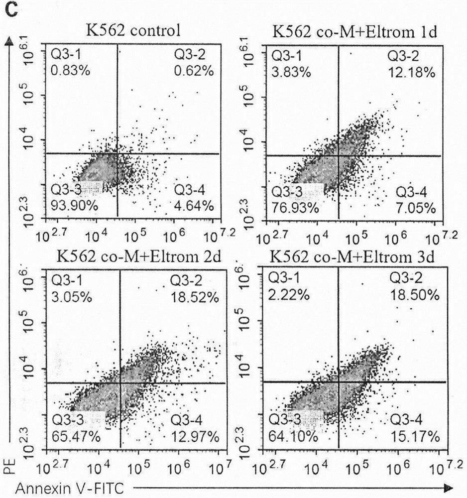 Application of mesenchymal stem cells combined with TPO and analogues thereof in treatment of chronic myeloid leukemia