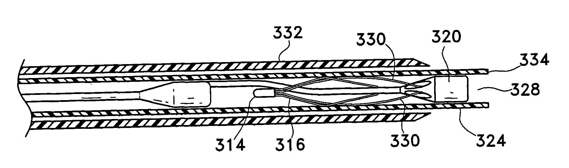 Filter delivery system