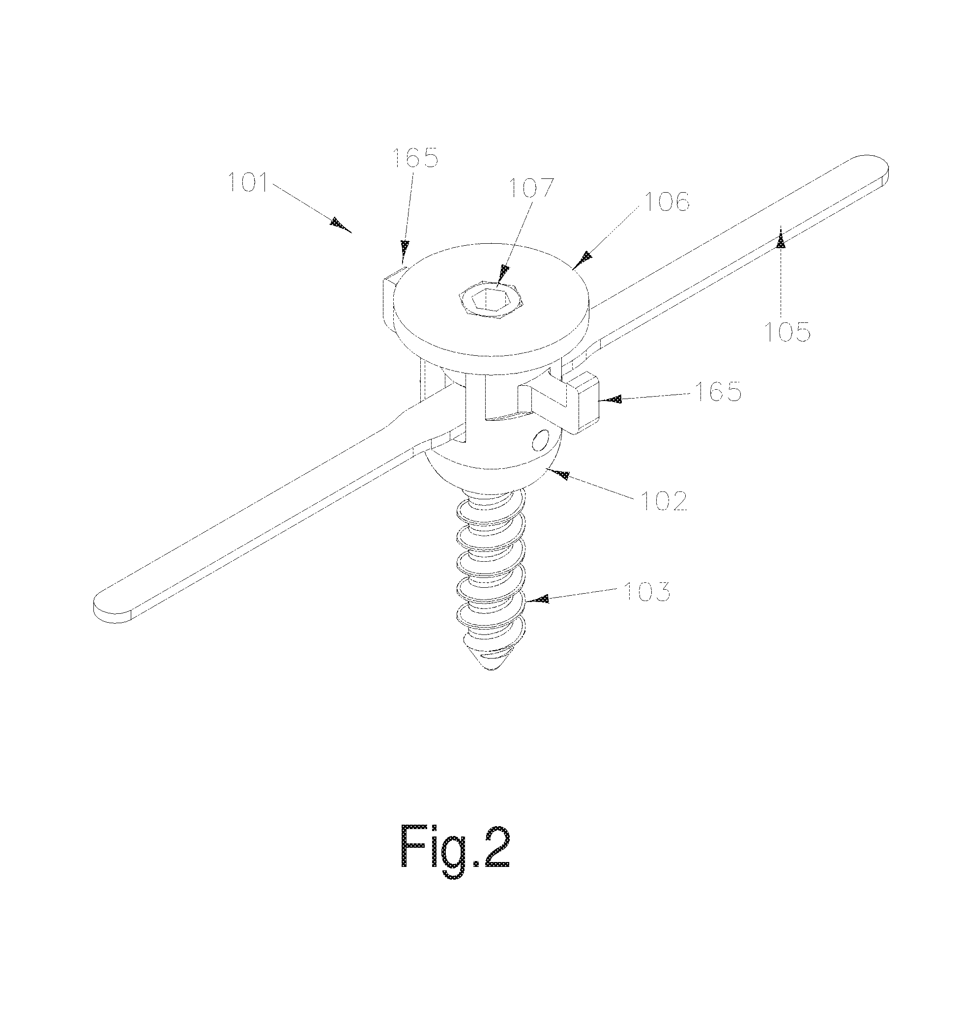 Method and apparatus for the treatment of scoliosis