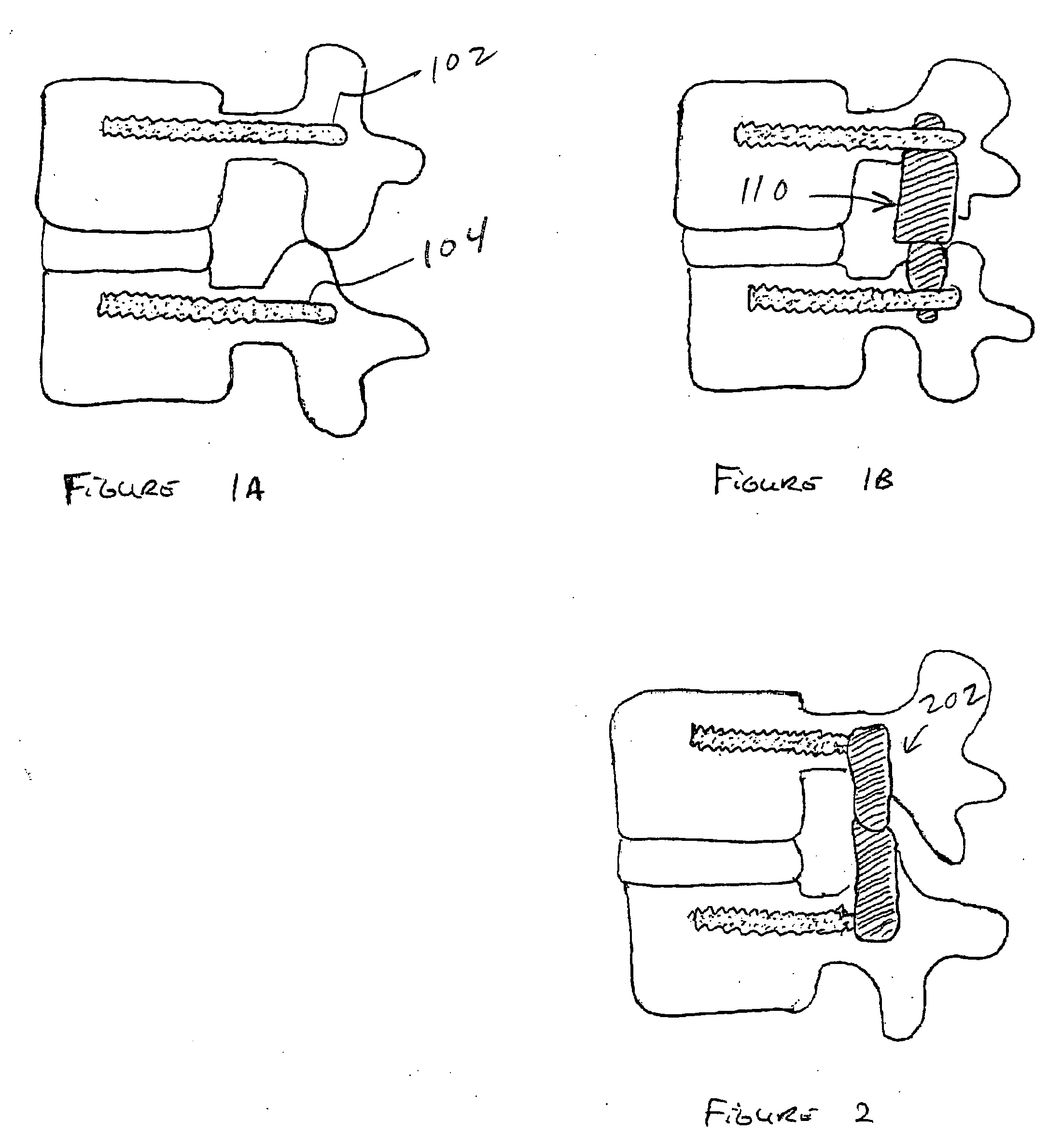 Methods and apparatus to prevent movement through artificial disc replacements