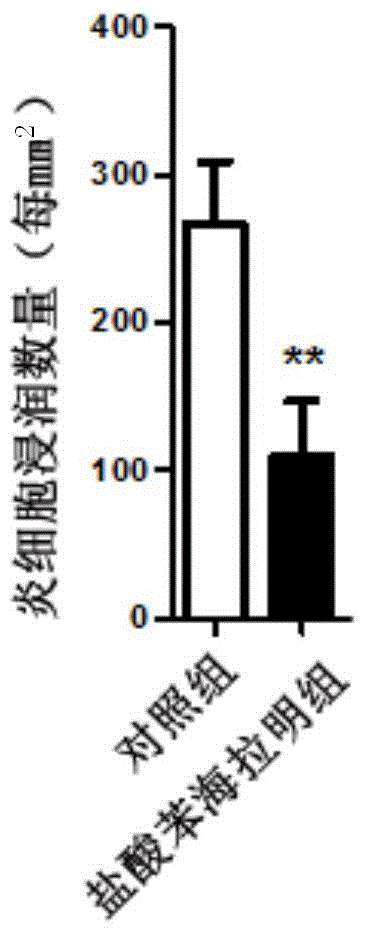 Application of diphenhydramine hydrochloride in preparation of medicine for treating experimental auto-immune encephalomyelitis